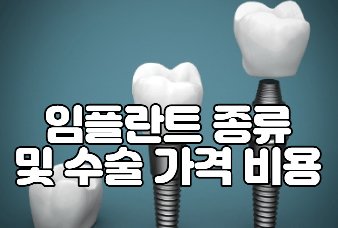 임플란트 종류 및 수술 가격 비용