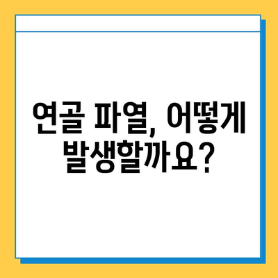 연골 파열, 가벼운 문제가 아니다| 증상, 원인, 치료 및 관리 | 연골 손상, 운동 부상, 재활