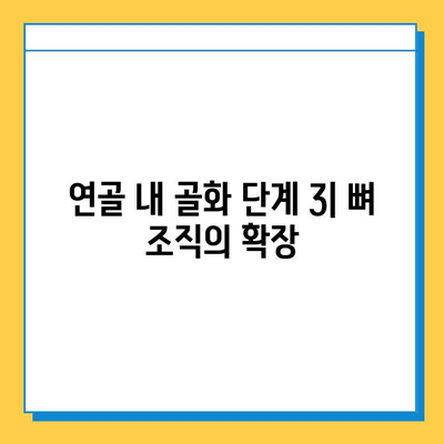 연골 내 골화의 진행 단계| 4단계 상세 분석 | 연골, 골화, 성장판, 뼈 형성