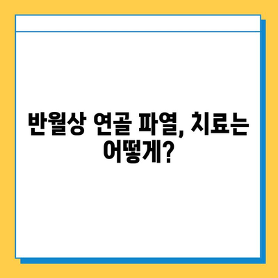 무릎 구부릴 때 통증? 반월상 연골 파열 의심해보세요| 증상, 진단, 치료 | 무릎 통증, 반월상 연골, 운동, 재활