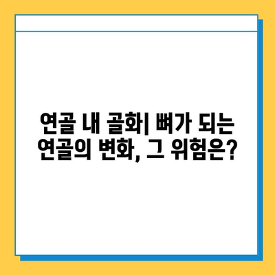 연골 내 골화의 숨은 위험| 미래 합병증 이해하기 | 연골 내 골화, 골화, 합병증, 건강