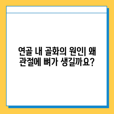 연골 내 골화로 인한 관절 통증| 원인과 해결책 | 관절 건강, 통증 관리, 치료 방법