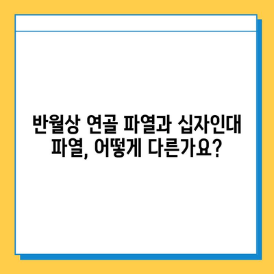 반월상 연골 파열 vs 십자인대 파열| 어떤 치료가 필요할까요? | 무릎 부상, 치료법, 재활