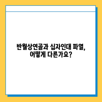 반월상연골 파열 & 십자인대 파열| 어떤 치료가 나에게 맞을까? | 비교 가이드, 치료법, 재활