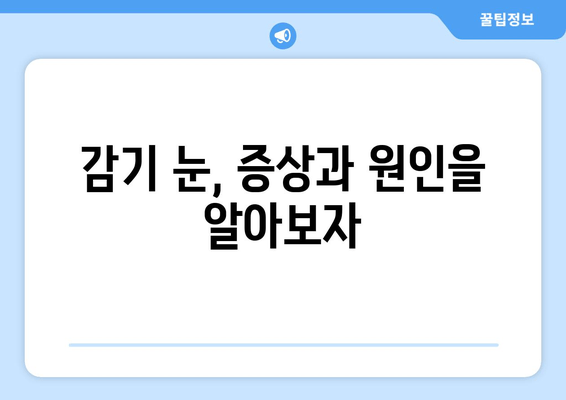 감기눈, 왜 생길까? 원인과 눈 건강 관리법 | 눈 건강, 감기, 컨디션 관리, 눈 관리 팁